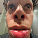 Pill